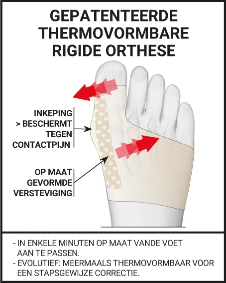 GEPATENTEERDE THERMOVORMBARE RIGIDE ORTHESE