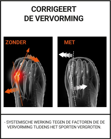 CORRIGERENDE HALLUX VALGUS ORTHESE SPORT