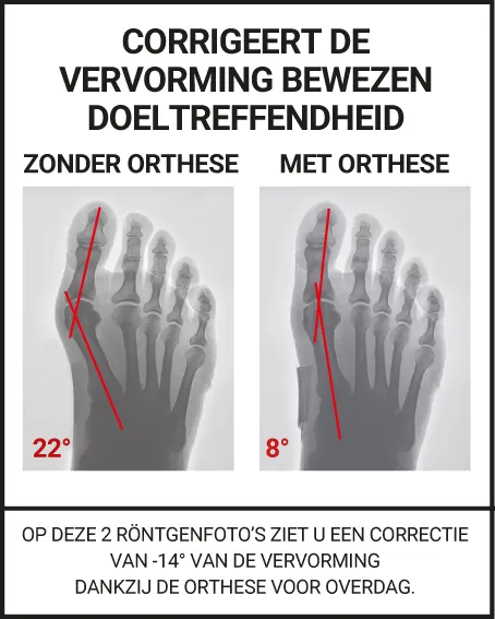 CORRIGEERT DE VERVORMING BEWEZEN DOELTREFFENDHEID