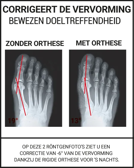 CORRIGEERT DE VERVORMING BEWEZEN DOELTREFFENDHEID